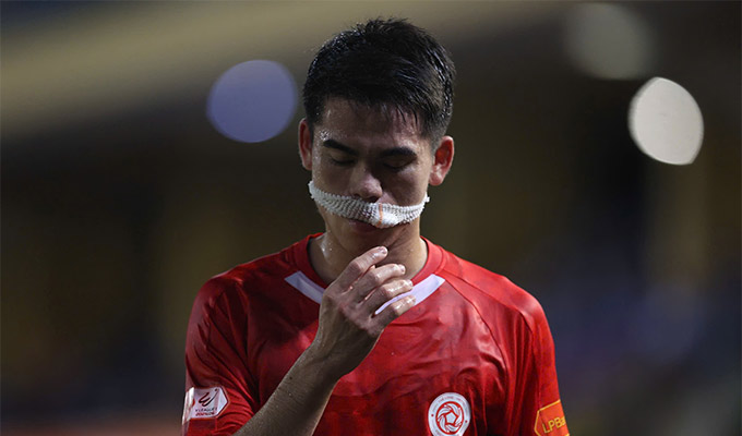 Văn Khang phải khâu 10 mũi ở miệng sau chấn thương trong trận đấu với CA TP.HCM - Ảnh: Đức Cường 