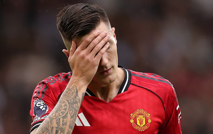 Sesko bước đầu đang gây thất vọng tràn trề