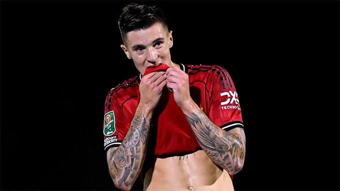 Sesko bị chỉ trích sau trận thua Man City đêm Chủ nhật