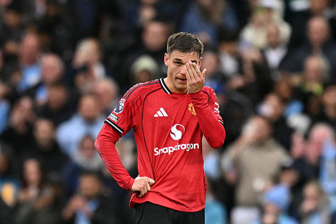 Ugarte thường xuyên chuyền hỏng và cũng chẳng đóng góp được nhiều cho khả năng phòng ngự của MU