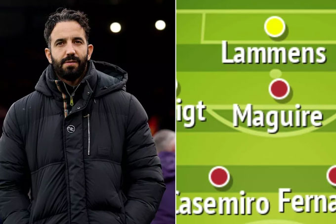 Amorim sẽ cần phải đưa ra lựa chọn chính xác về cách xếp đội hình MU khi đối đầu Brighton