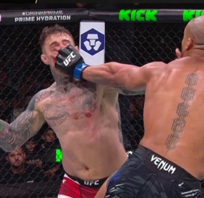 Aspinall bị chọc vào mắt