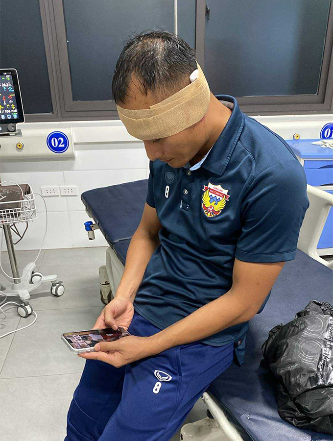 Trọng Hoàng phải khâu 10 mũi ở tai và hiện sức khỏe đã ổn định 