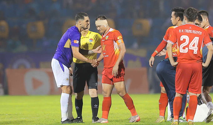 Trọng Hoàng bị chấn thương ở tai sau pha va chạm với Hoàng Hên - Ảnh: Đức Cường 