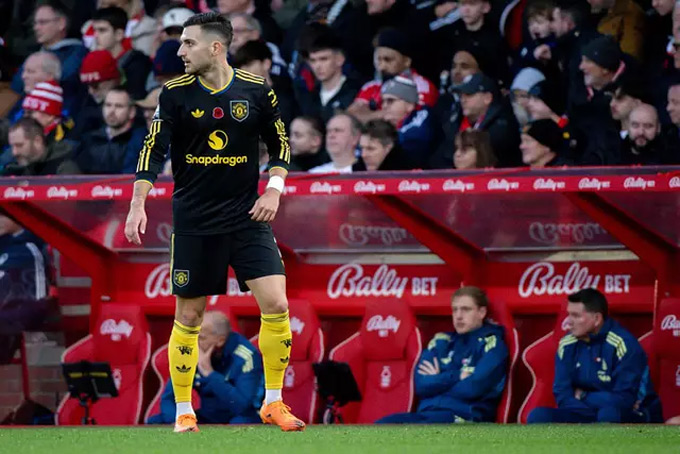 Dalot đã chơi rất tệ trước Nottingham