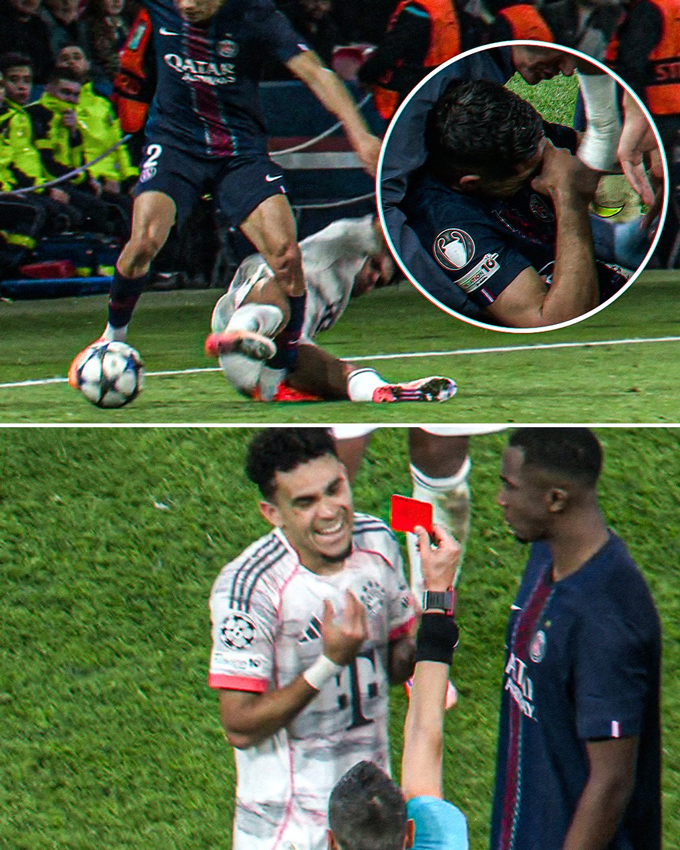 Diaz khiến Hakimi đau đớn rời sân