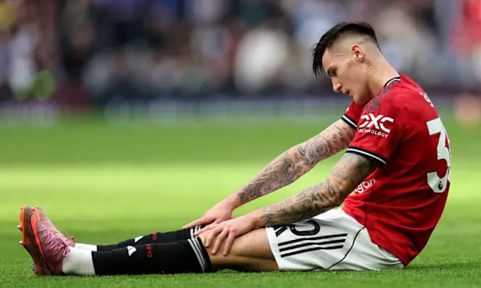 Sesko đã bình phục chấn thương nhưng lại bị ngộ độc thực phẩm