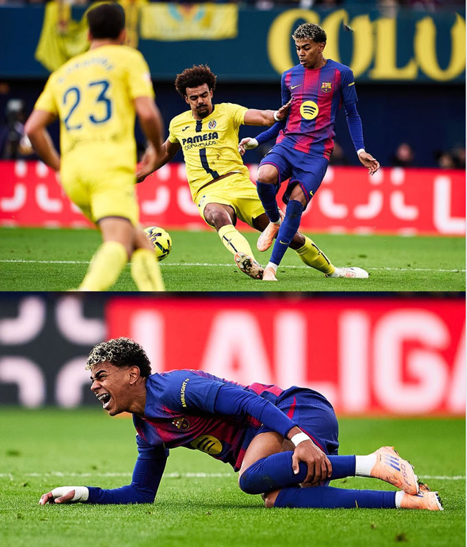 Yamal hứng chịu pha vào bóng thô bạo của Veiga