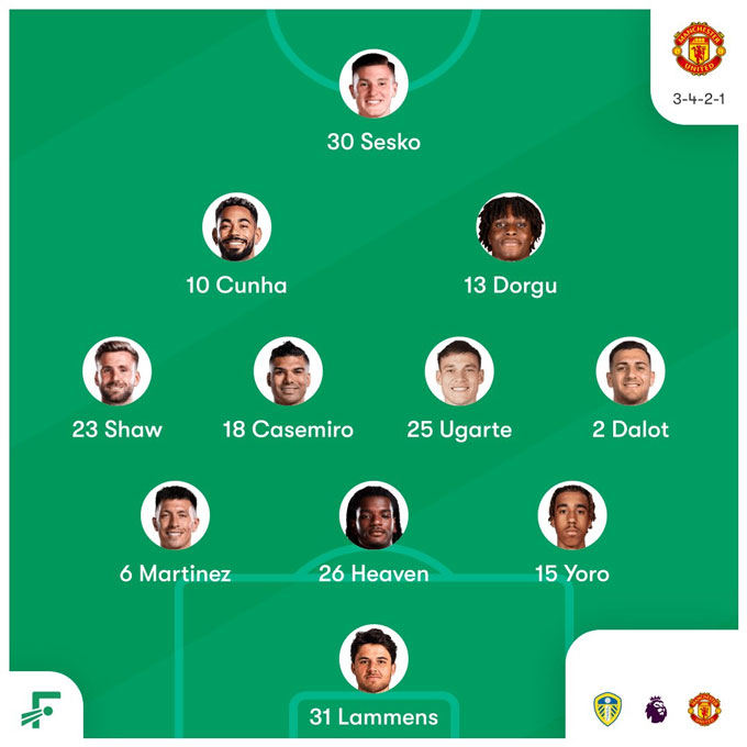 MU ra sân với 6 hậu vệ và 2 tiền vệ có xu hướng phòng ngự