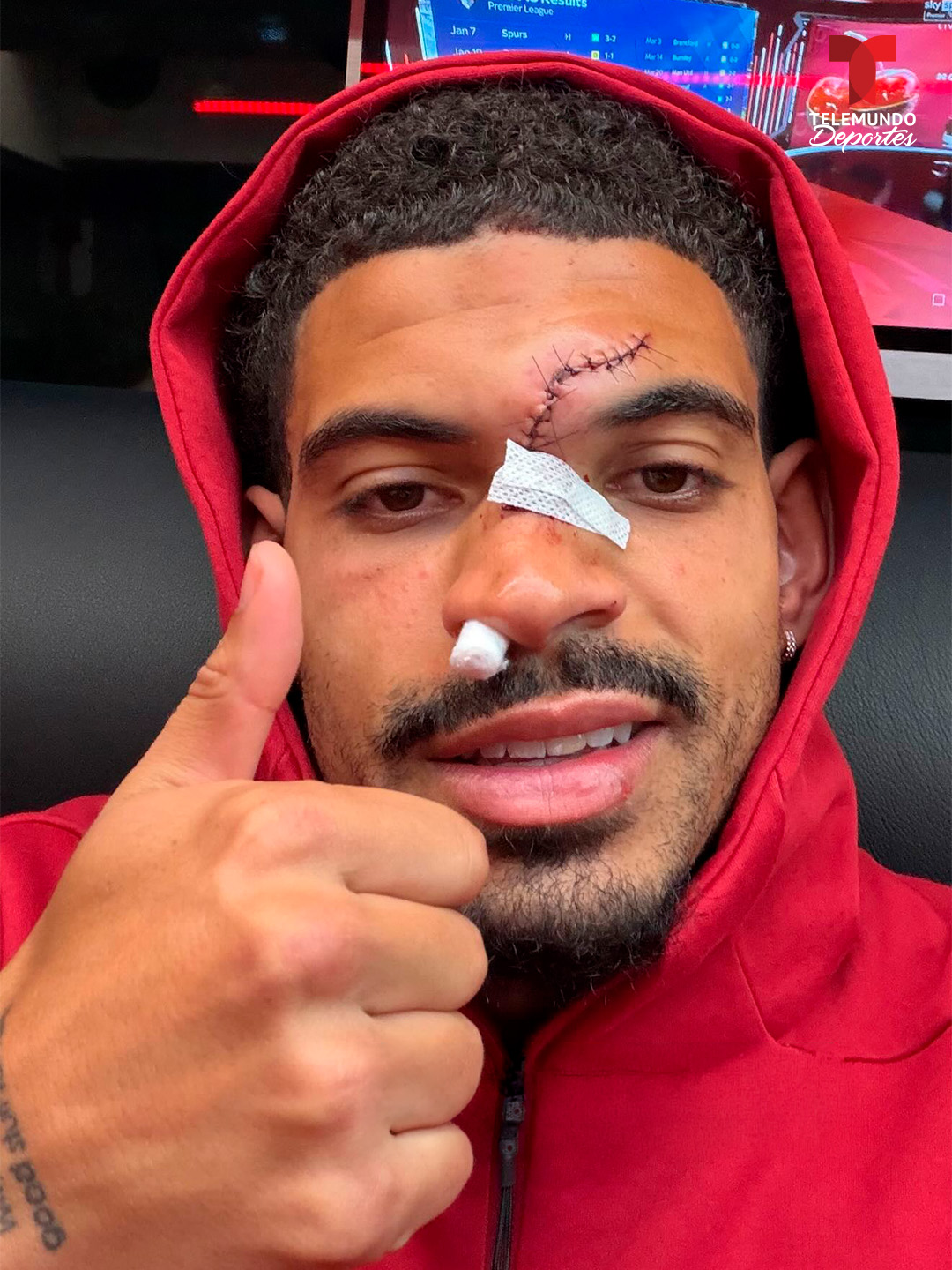 Gibbs-White có thể ra sân trước Aston Villa? 