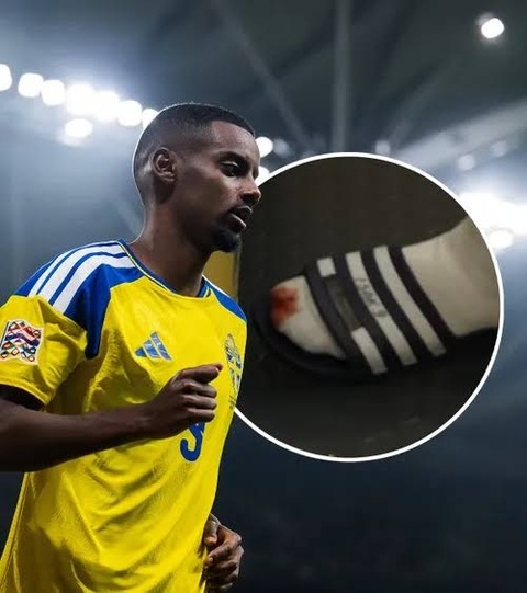 Isak bị chảy máu ngón chân và chấn thương đùi ở trận gặp Romania. Ảnh: Golazo